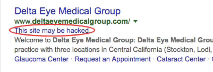 site指令提示警告